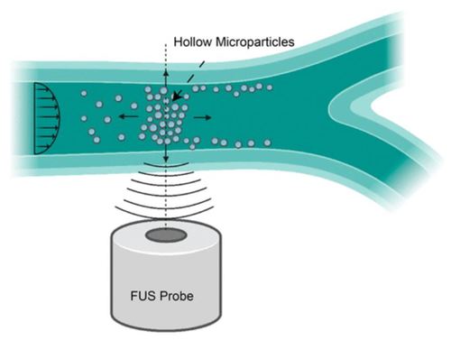 Acoustic Trapping and Manipulation of Hollow Microparticles under Fluid Flow Using a Single-Lens Focused Ultrasound Transducer